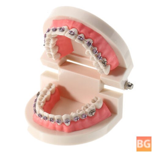 Teeth Orthodontic Model with Metal Brackets and Hoops